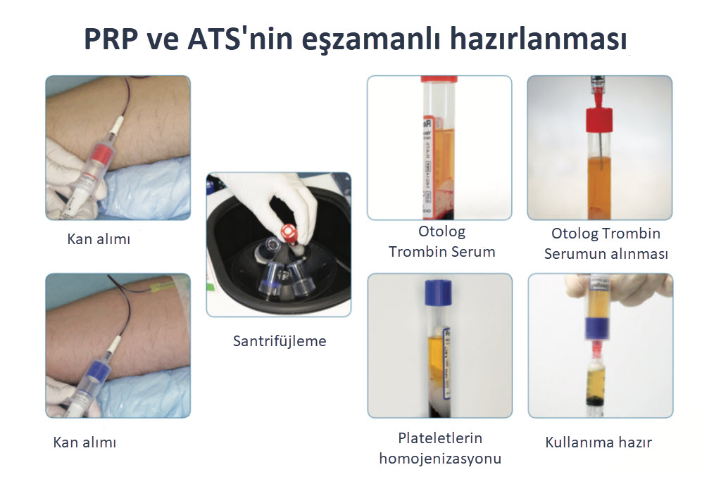 Regenlab ATS